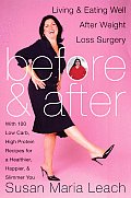 Before & After: Living & Eating Well After Weight Loss Surgery Cover
