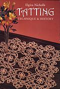 Tatting: Technique and History