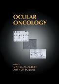 Ocular Oncology