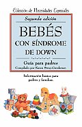 Bebes Con Sindrome De Down 2ND Edition