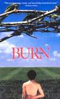 Burn Cover