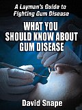 What You Should Know about Gum Disease