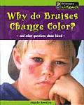 Why Do Bruises Change Color?: And Other Questions about Blood (Body Matters) Cover