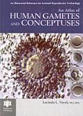 An Atlas of Human Gametes and Conceptuses (Bar International Series) Cover