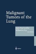 Malignant Tumors of the Lung: Evidence Based Management