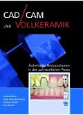 Cad/cam Und Vollkeramik