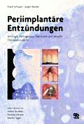 Periimplantäre Entzündungen