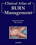 Clinical Atlas of Burn Management.