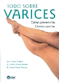 Todo Sobre Varices: Como Prevenirlas Como Curarlas (Coleccion Todo Sobre--)
