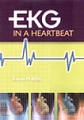 Ekg In A Heartbeat
