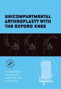 Unicompartmental Arthroplasty with the Oxford Knee [With DVD]
