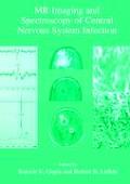 MR Imaging and Spectroscopy of Central Nervous System Infection