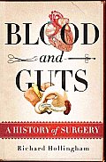 Blood & Guts A History of Surgery