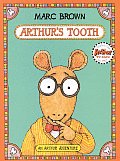 Arthurs Tooth