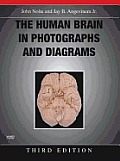 Human Brain in Photographs & Diagrams with CDROM