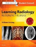 Learning Radiology Recognizing The Basics