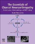 The Essentials of Charcot Neuroarthropathy: Biomechanics, Pathophysiology, and MRI Findings