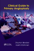 Clinical Guide to Primary Angioplasty
