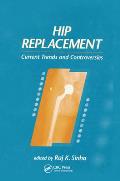 Hip Replacement: Current Trends and Controversies