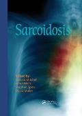 Sarcoidosis