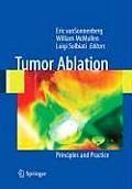 Tumor Ablation: Principles and Practice