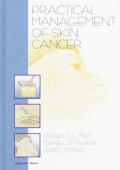 Practical management of skin cancer