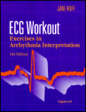 Ecg Workout Exercises In Arrhythmia Int