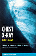 Chest X Ray Made Easy