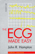 Ecg Made Easy