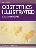 Obstetrics Illustrated (Hanretty, Obstetrics Illustrated)