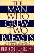 Man Who Grew Two Breasts & Other True