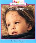 Rookie Read About Health Chickenpox