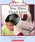 You Have Head Lice!