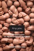 Tiny You A Western History of the Anti Abortion Movement