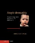 Atopic Dermatitis: The Epidemiology, Causes and Prevention of Atopic Eczema