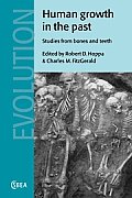 Human Growth in the Past: Studies from Bones and Teeth