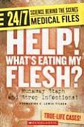 Help! Whats Eating My Flesh?: Runaway Staph and Strep Infections! (24/7: Science Behind the Scenes: Medical Files)