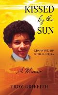 Kissed by the Sun: Growing Up with Alopecia