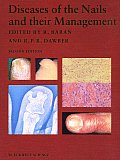 Diseases of the Nails & Their Management
