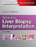Scheuers Liver Biopsy Interpretation