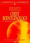 Felsons Principles Of Chest Roentgen 2nd Edition