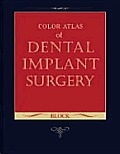 Color Atlas Of Dental Implant Surgery