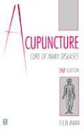 Acupuncture Cure Of Many Diseases