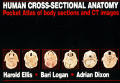 Human Cross Sectional Anatomy Pocket Atlas of Body Sections & CT Images