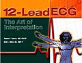 12 Lead Ecg The Art Of Interpretation