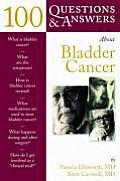 100 Questions & Answers about Bladder Cancer