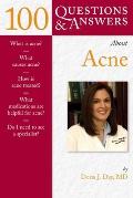 100 Questions & Answers about Acne