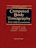 Computed Body Tomography With Mri Correl