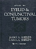 Atlas Of Eyelid & Conjunctival Tumors