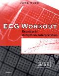 Ecg Workout Exercises In Arrhythmia 4th Edition